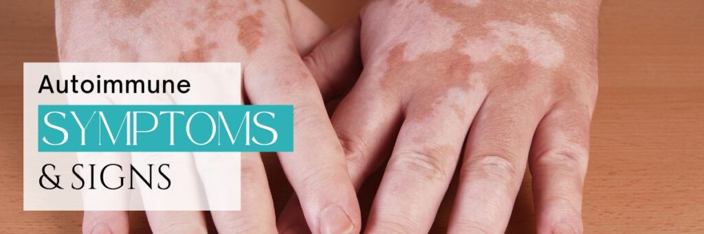 Autoimmune Symptoms & Impact