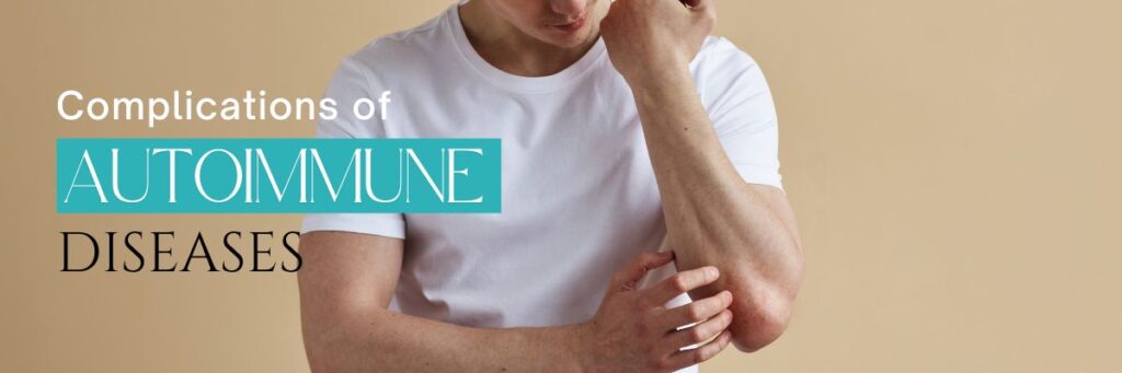 Complications of Autoimmune Diseases