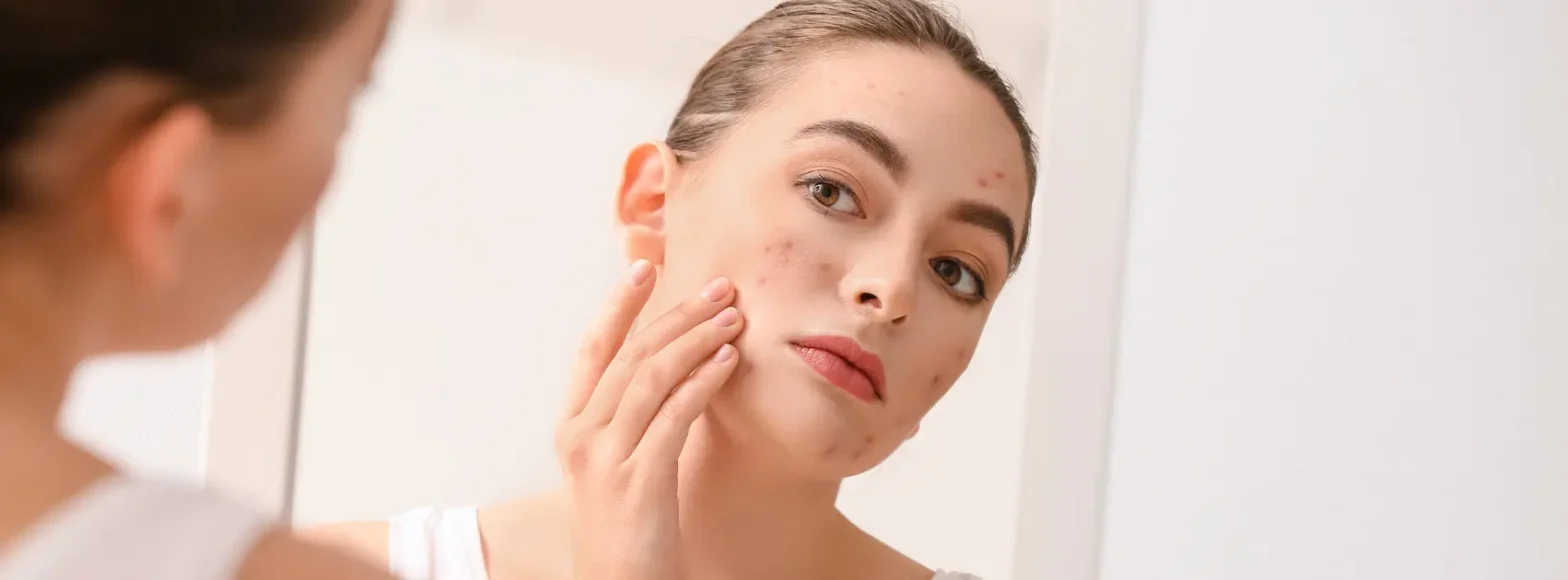 Eczema Treatment in Oakville