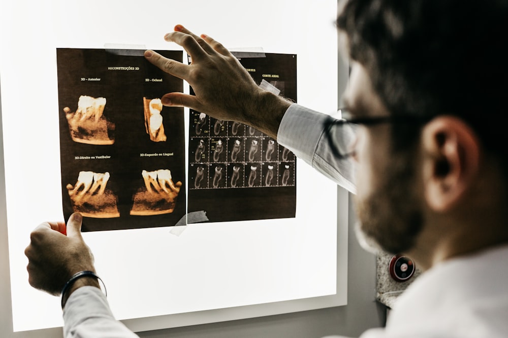 Personalized assessment for psoriasis types